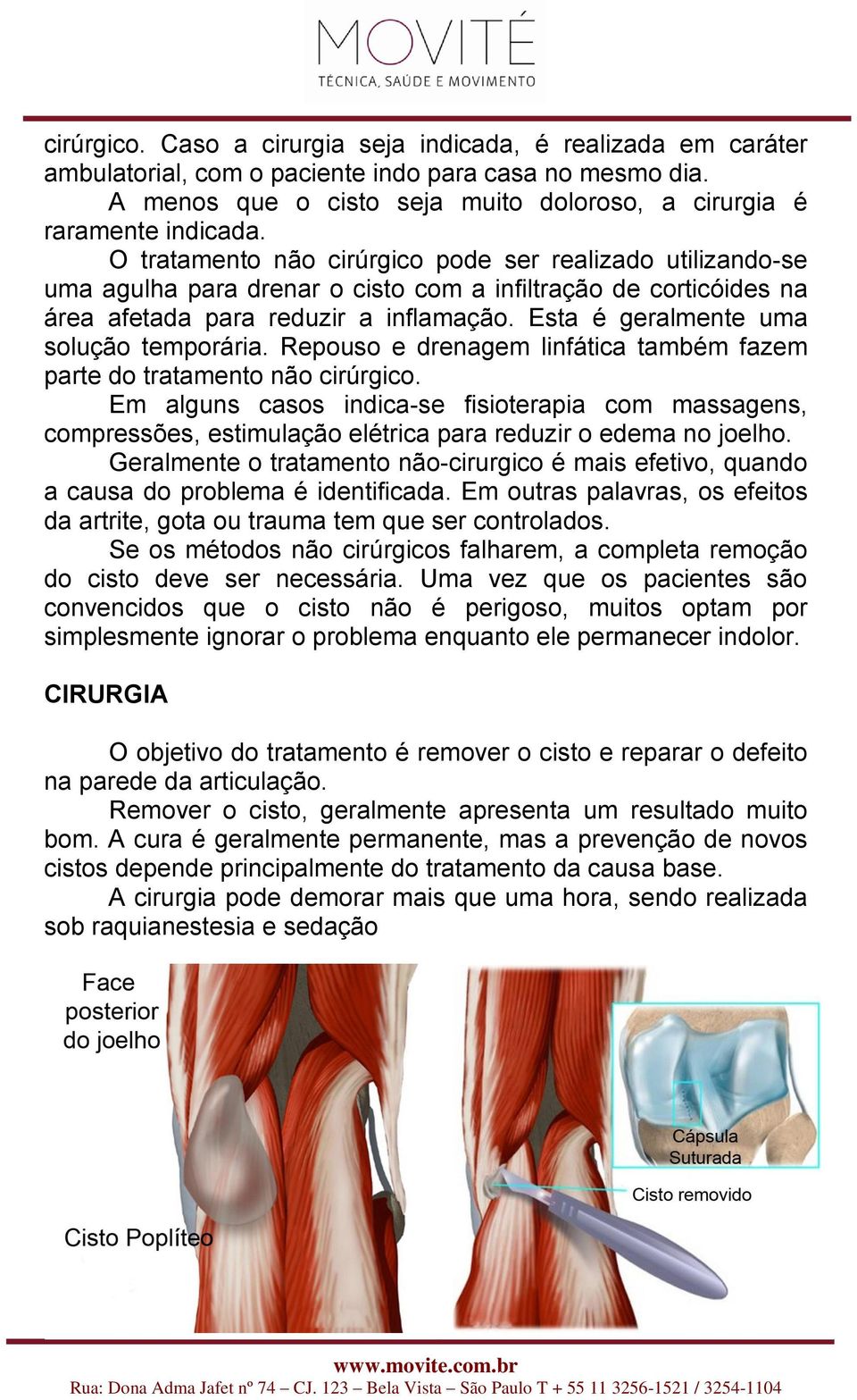 Esta é geralmente uma solução temporária. Repouso e drenagem linfática também fazem parte do tratamento não cirúrgico.