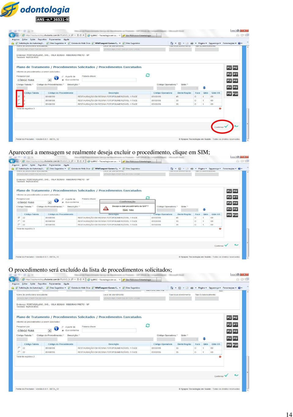 em SIM; O procedimento será excluído