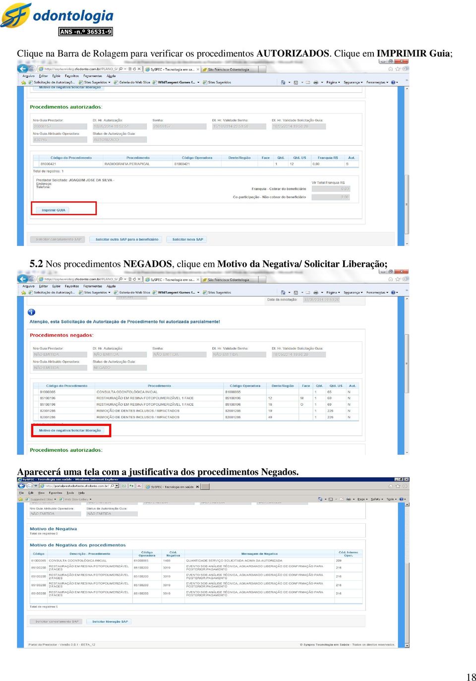 2 Nos procedimentos NEGADOS, clique em Motivo da Negativa/