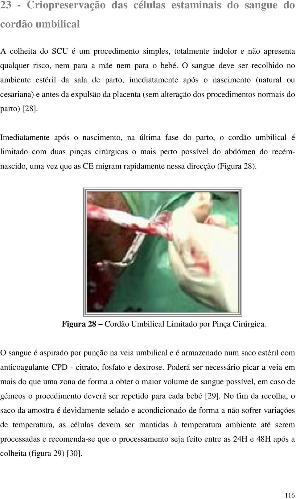 Imediatamente após nasciment, na última fase d part, crdã umbilical é limitad cm duas pinças cirúrgicas mais pert pssível d abdómen d recémnascid, uma vez que as CE migram rapidamente nessa direcçã