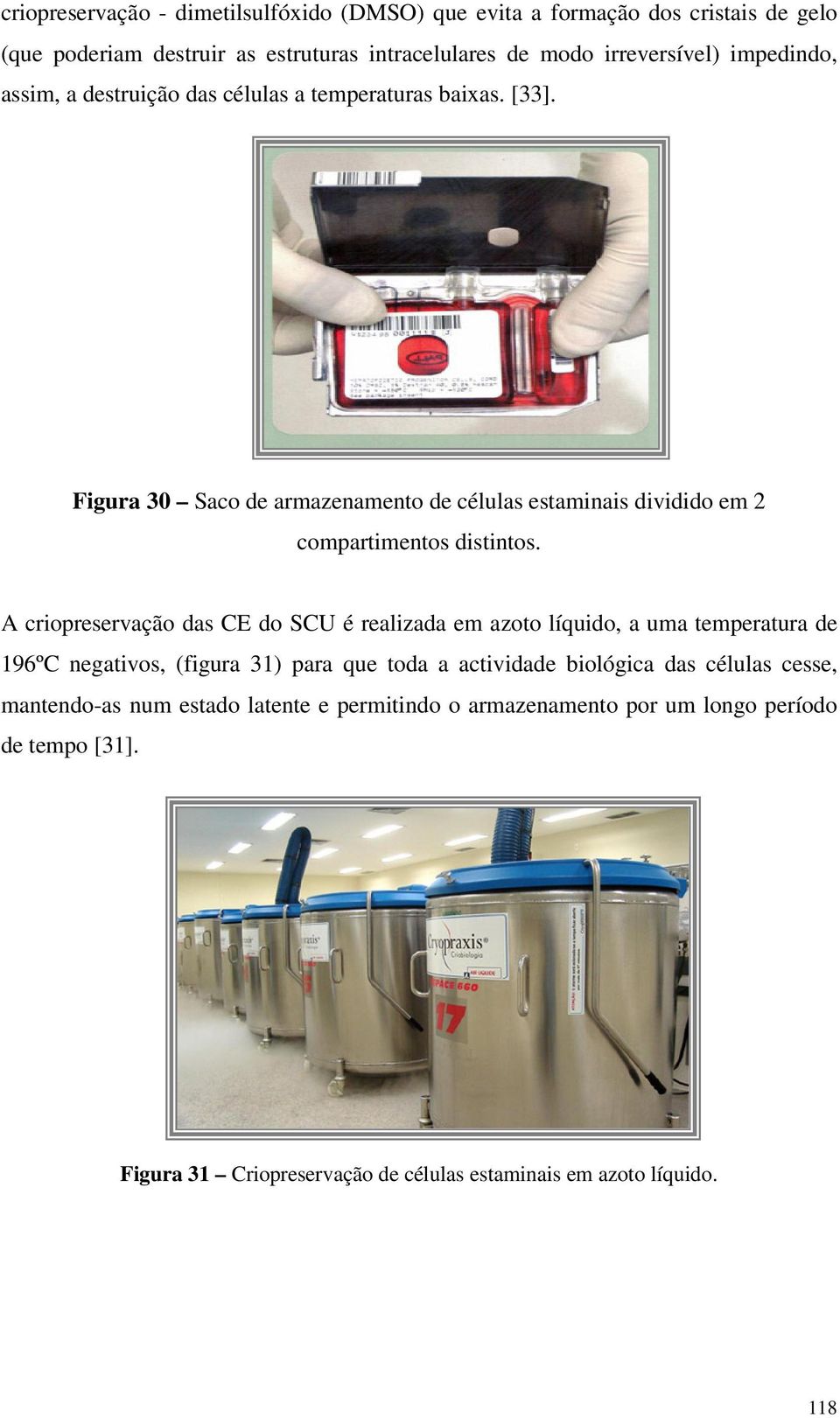 Figura 30 Sac de armazenament de células estaminais dividid em 2 cmpartiments distints.