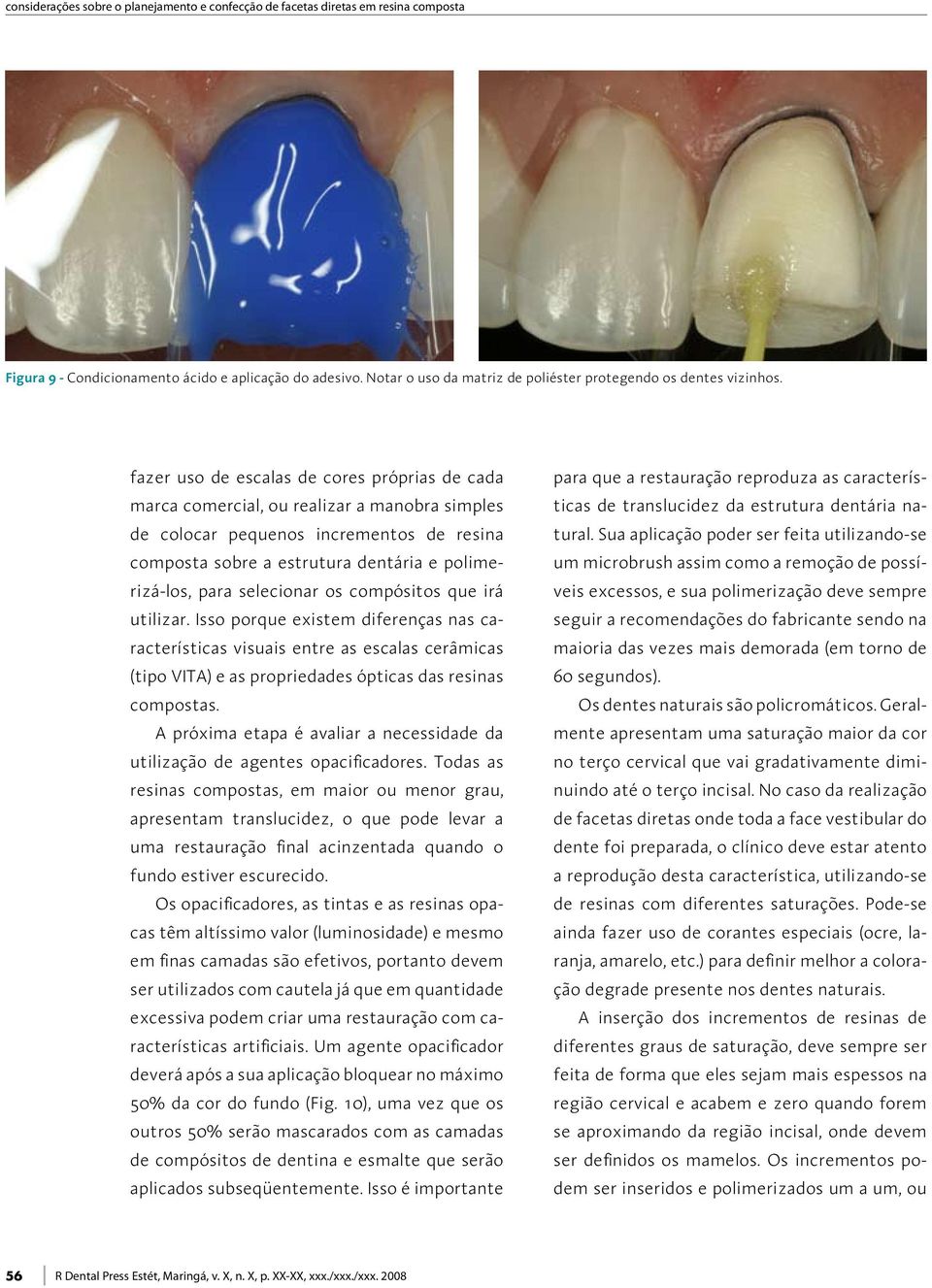 fazer uso de escalas de cores próprias de cada marca comercial, ou realizar a manobra simples de colocar pequenos incrementos de resina composta sobre a estrutura dentária e polimerizá-los, para