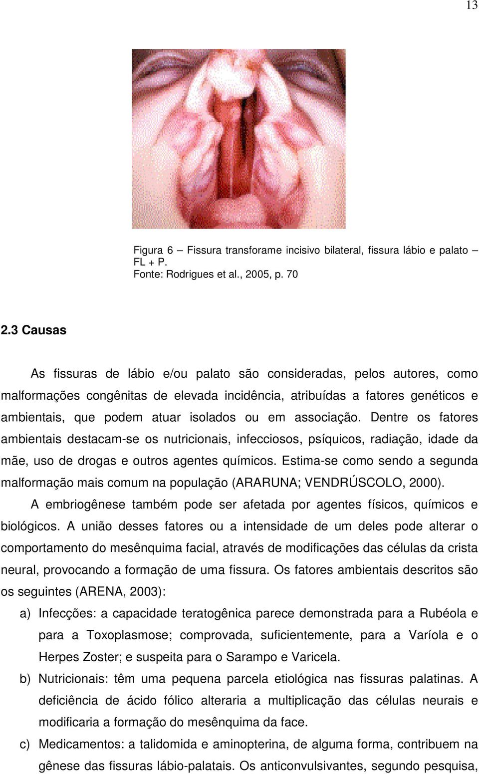 em associação. Dentre os fatores ambientais destacam-se os nutricionais, infecciosos, psíquicos, radiação, idade da mãe, uso de drogas e outros agentes químicos.