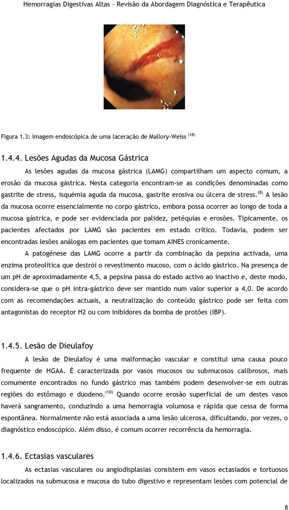 Nesta categoria encontram-se as condições denominadas como gastrite de stress, isquémia aguda da mucosa, gastrite erosiva ou úlcera de stress.