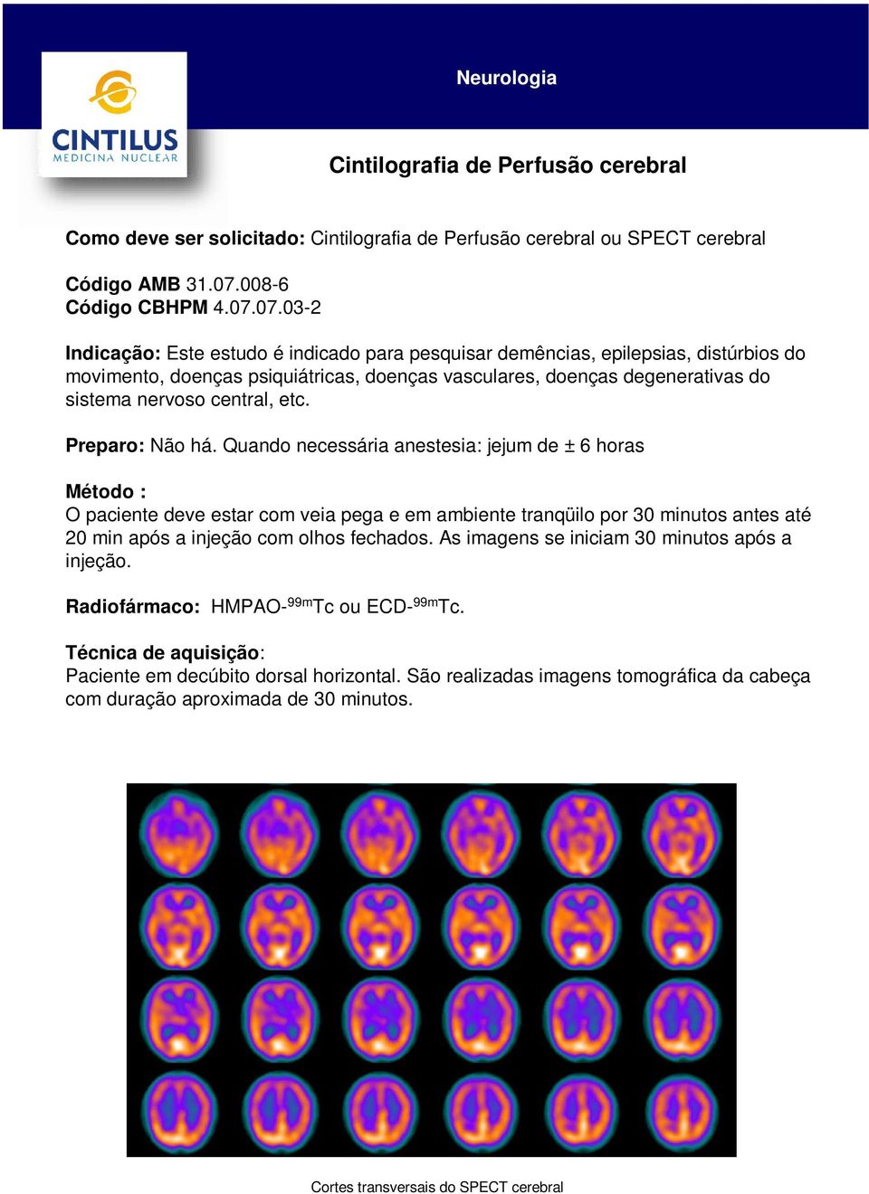 07.03-2 Indicação: Este estudo é indicado para pesquisar demências, epilepsias, distúrbios do movimento, doenças psiquiátricas, doenças vasculares, doenças degenerativas do sistema nervoso central,