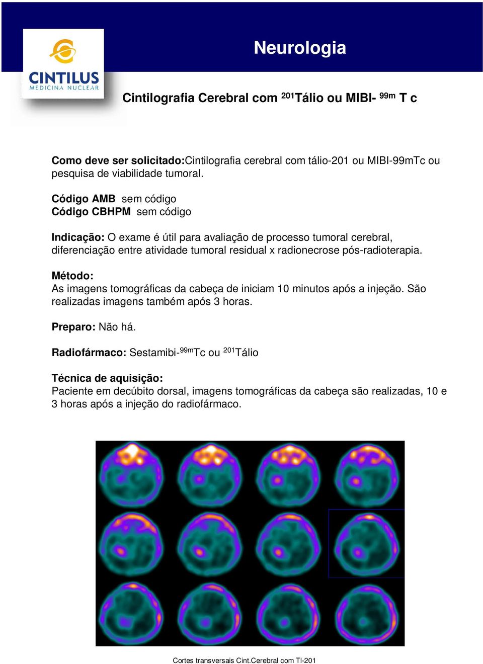 pós-radioterapia. Método: As imagens tomográficas da cabeça de iniciam 10 minutos após a injeção. São realizadas imagens também após 3 horas. Preparo: Não há.