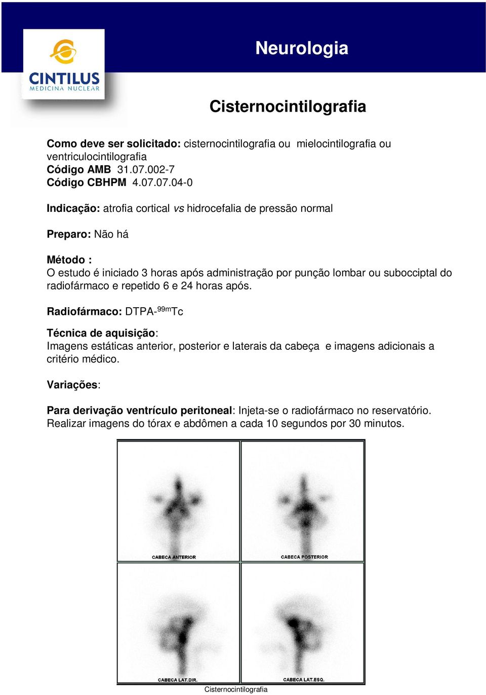 07.04-0 Indicação: atrofia cortical vs hidrocefalia de pressão normal Preparo: Não há O estudo é iniciado 3 horas após administração por punção lombar ou subocciptal do