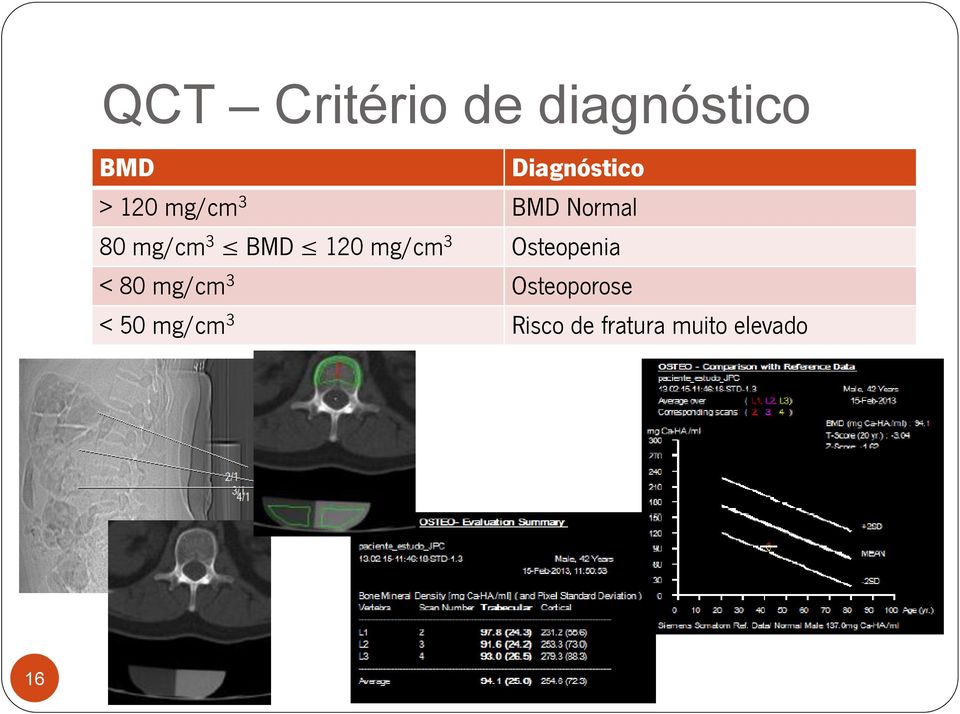 mg/cm 3 Osteopenia < 80 mg/cm 3 Osteoporose