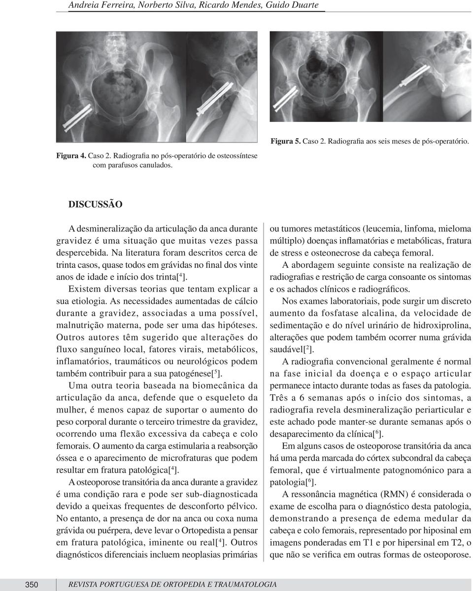 Na literatura foram descritos cerca de trinta casos, quase todos em grávidas no final dos vinte anos de idade e início dos trinta[ 4 ]. Existem diversas teorias que tentam explicar a sua etiologia.