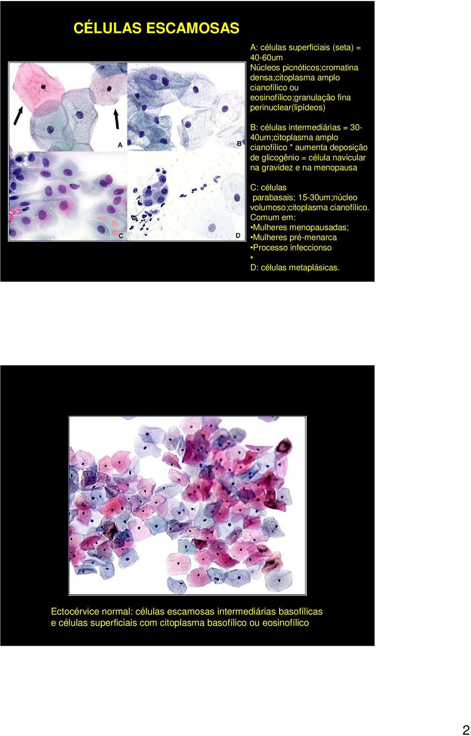 na menopausa C: células parabasais; 15-30um;núcleo volumoso;citoplasma cianofílico.