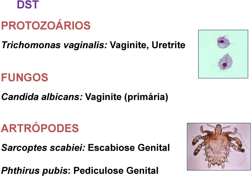 Vaginite (primária) ARTRÓPODES Sarcoptes