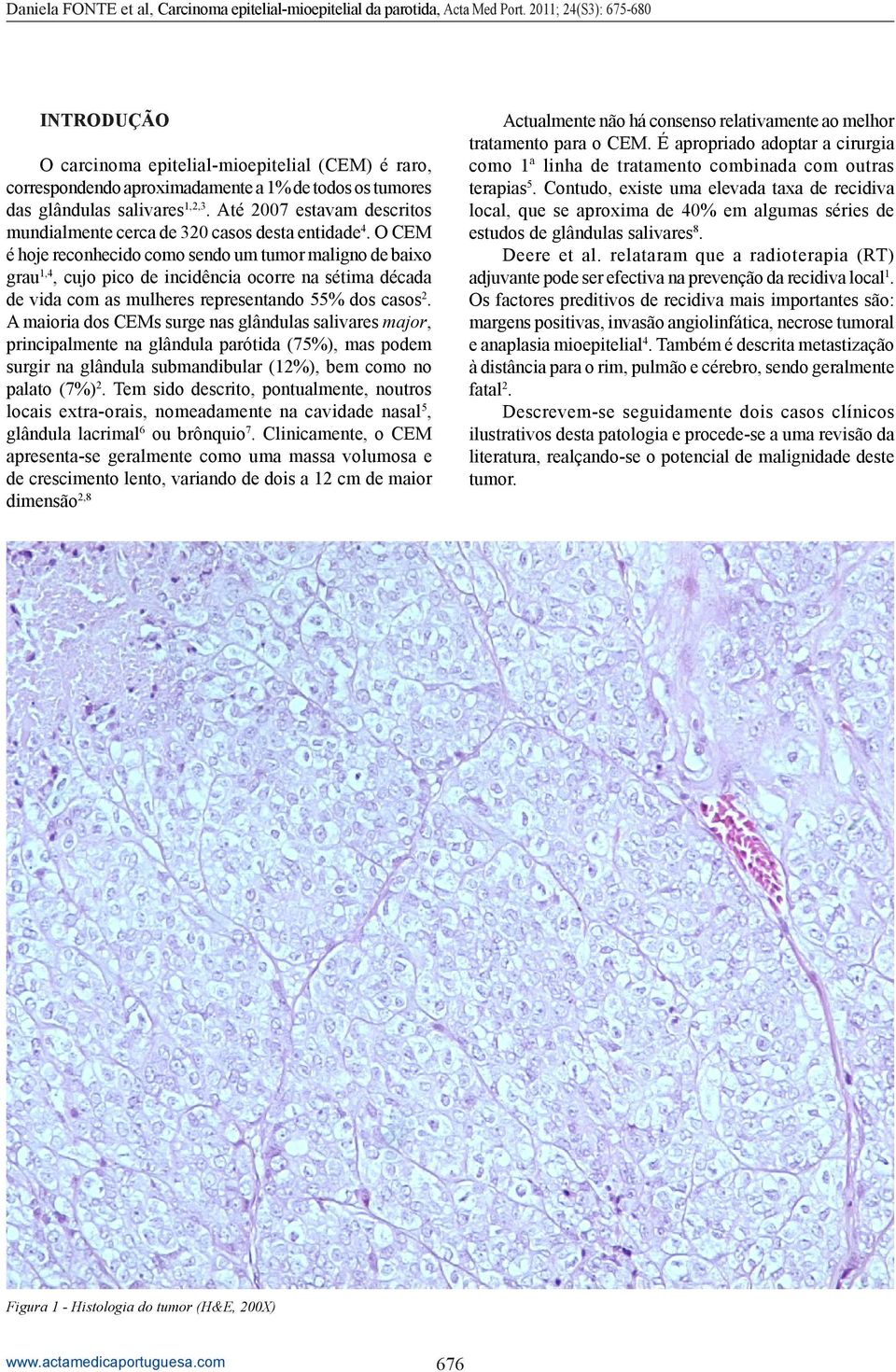 O CEM é hoje reconhecido como sendo um tumor maligno de baixo grau 1,4, cujo pico de incidência ocorre na sétima década de vida com as mulheres representando 55% dos casos 2.