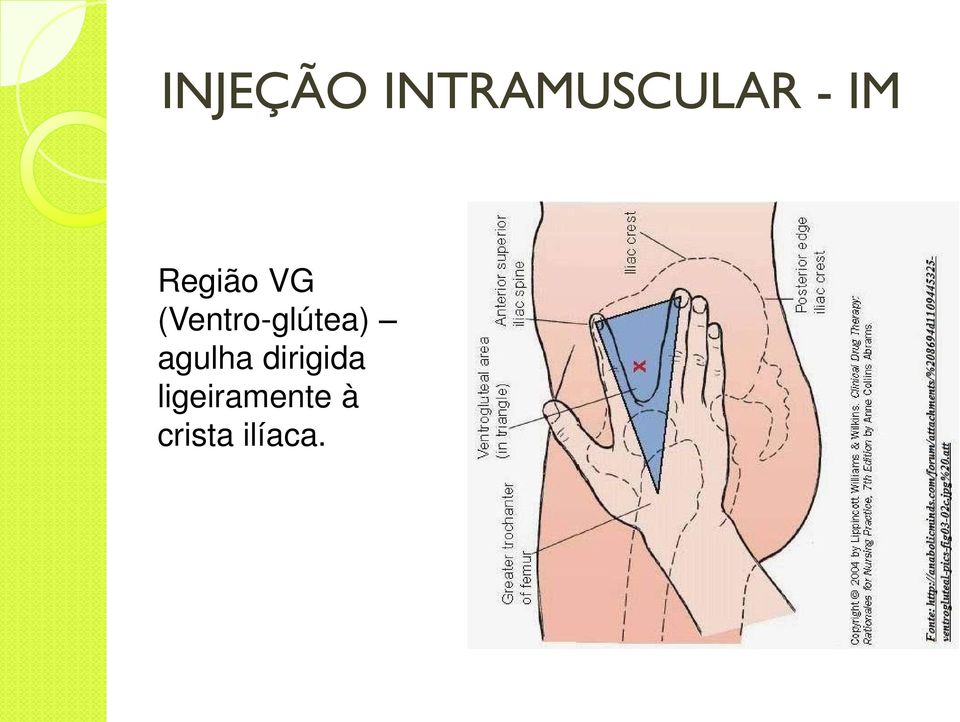 (Ventro-glútea) agulha