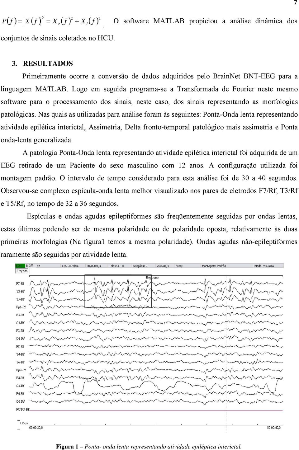 Logo em seguida programa-se a Transformada de Fourier neste mesmo software para o processamento dos sinais, neste caso, dos sinais representando as morfologias patológicas.