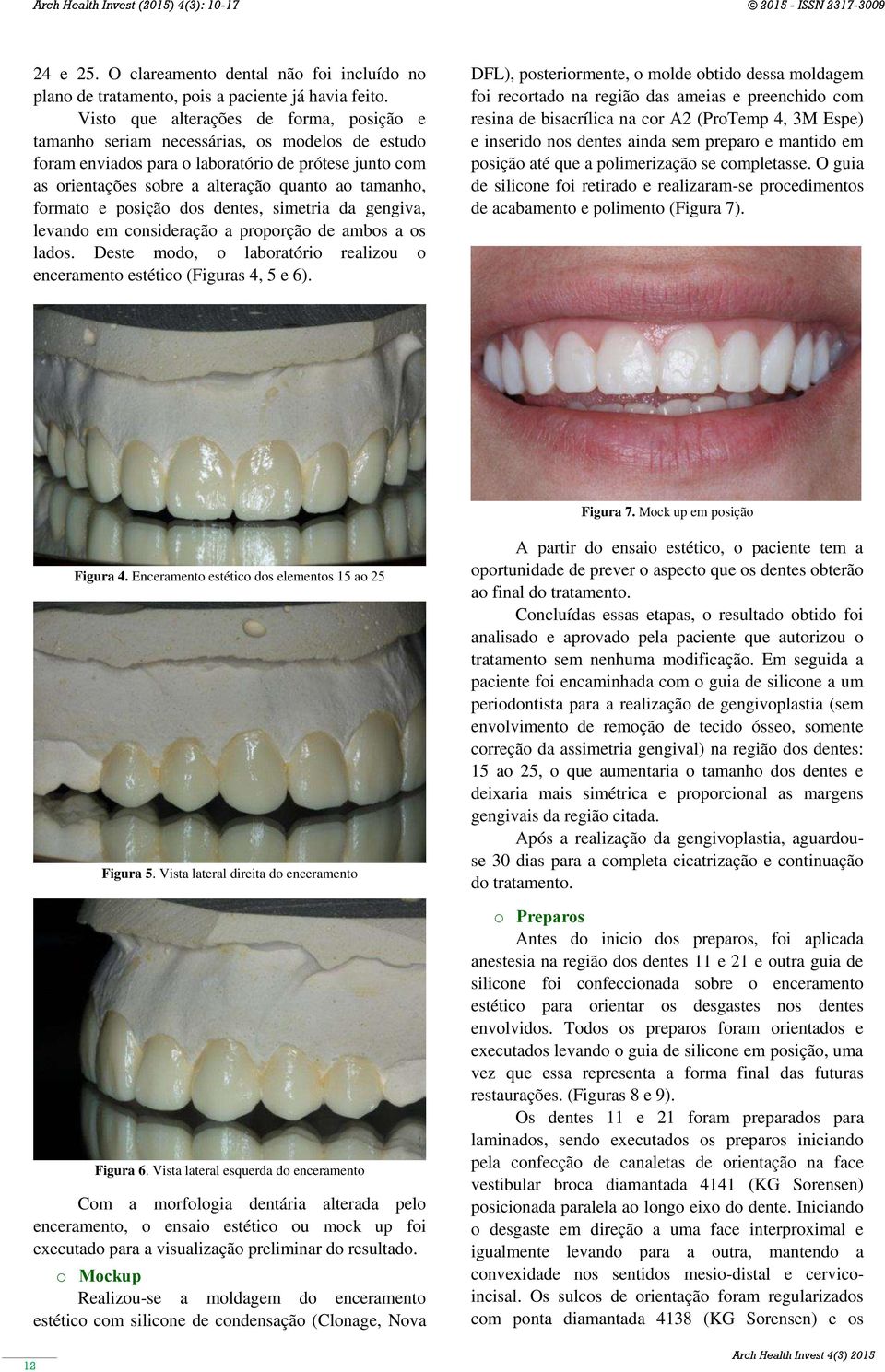 formato e posição dos dentes, simetria da gengiva, levando em consideração a proporção de ambos a os lados. Deste modo, o laboratório realizou o enceramento estético (Figuras 4, 5 e 6).