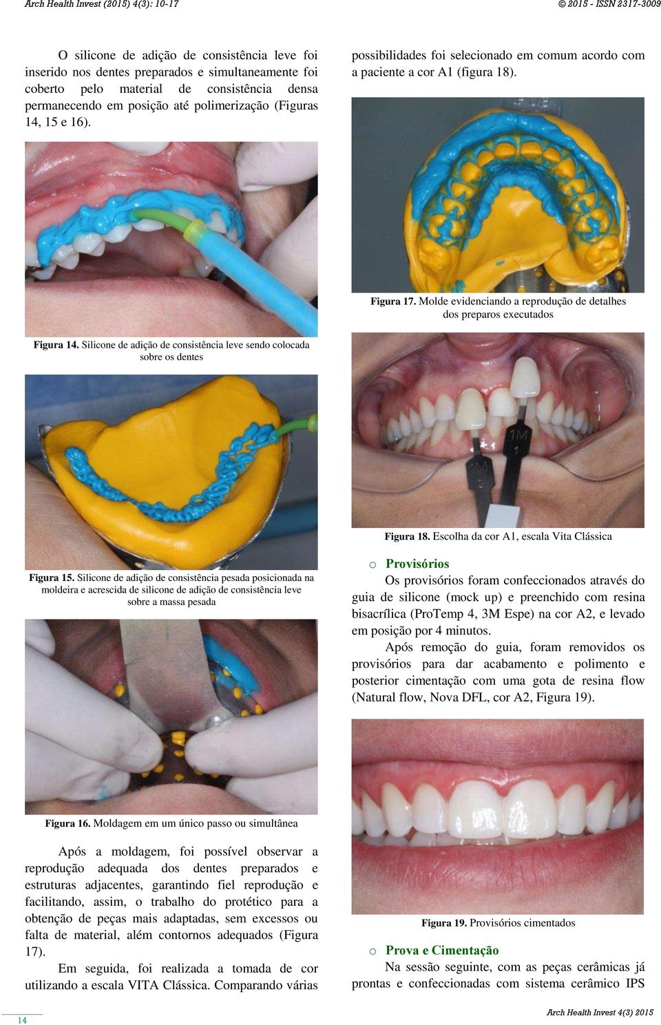 Silicone de adição de consistência leve sendo colocada sobre os dentes Figura 18. Escolha da cor A1, escala Vita Clássica Figura 15.