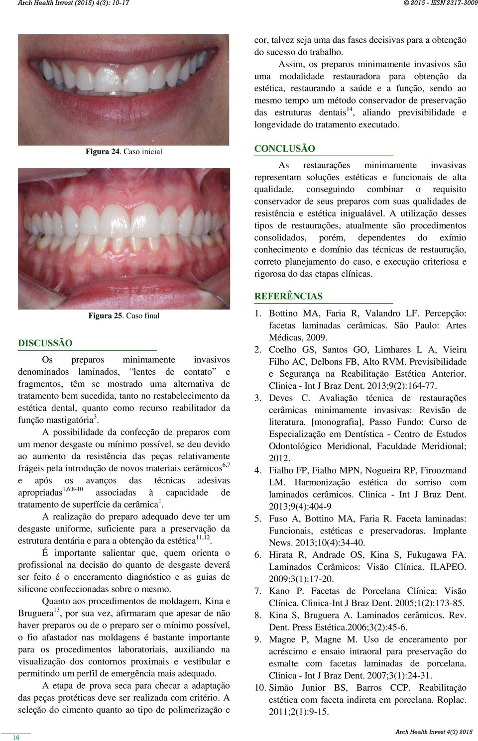 estruturas dentais 14, aliando previsibilidade e longevidade do tratamento executado. DISCUSSÃO Figura 24. Caso inicial Figura 25.
