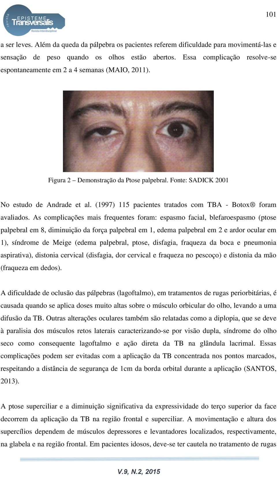 (1997) 115 pacientes tratados com TBA - Botox foram avaliados.