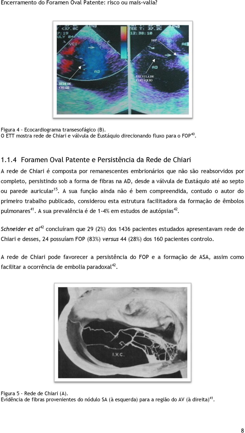 desde a válvula de Eustáquio até ao septo ou parede auricular 15.