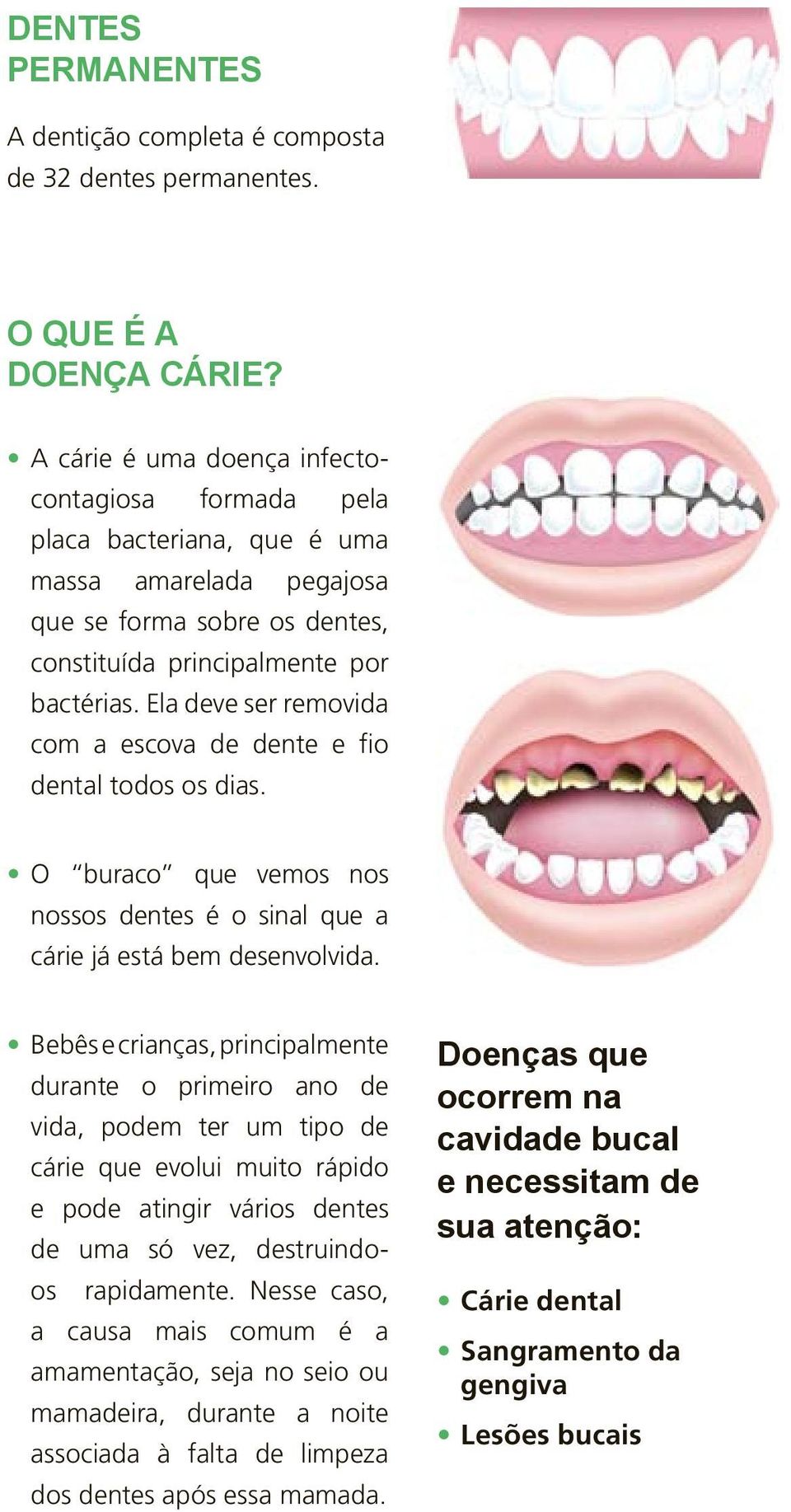 Ela deve ser removida com a escova de dente e fio dental todos os dias. O buraco que vemos nos nossos dentes é o sinal que a cárie já está bem desenvolvida.