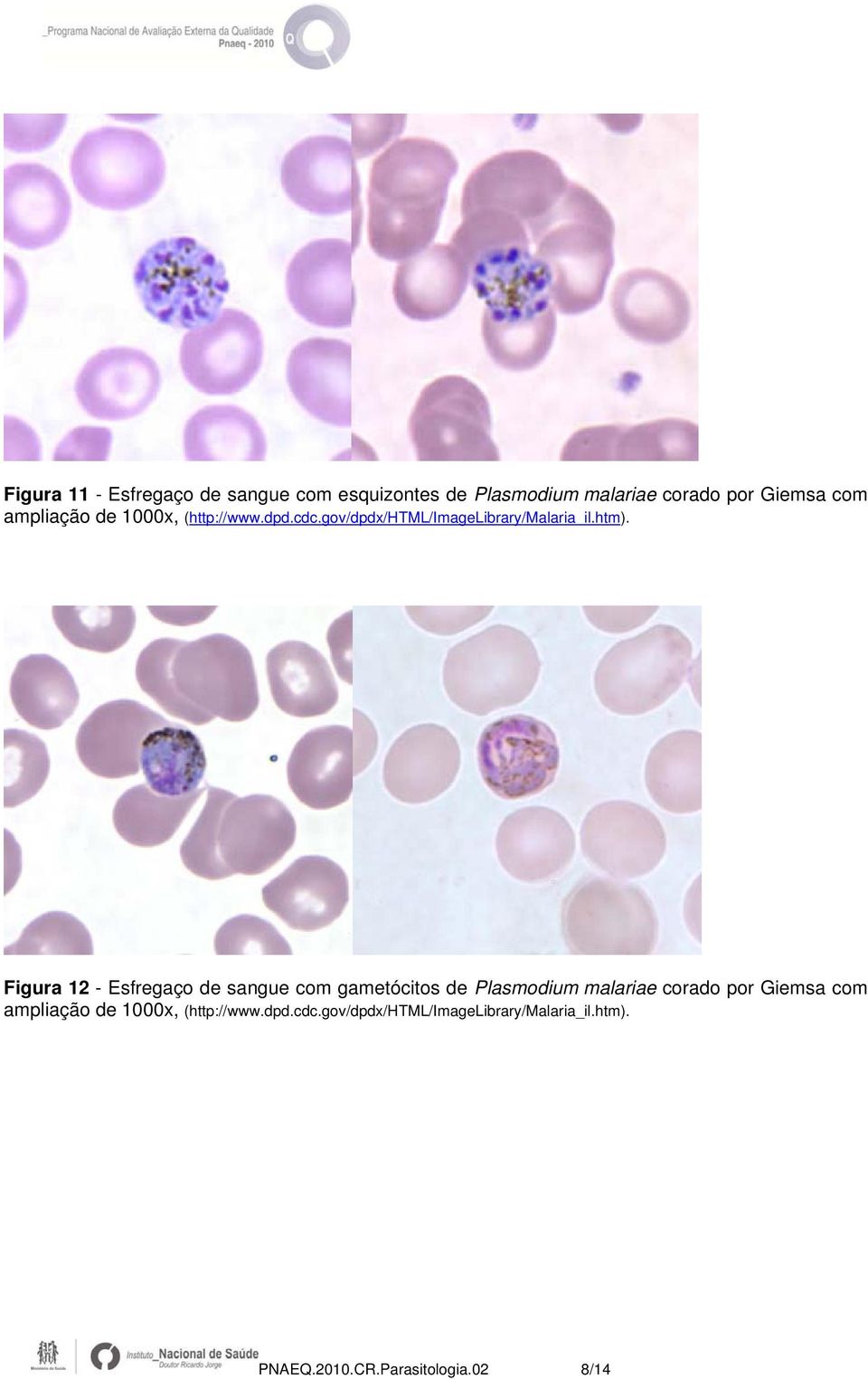 Figura 12 - Esfregaço de sangue com gametócitos de Plasmodium malariae corado por Giemsa com 