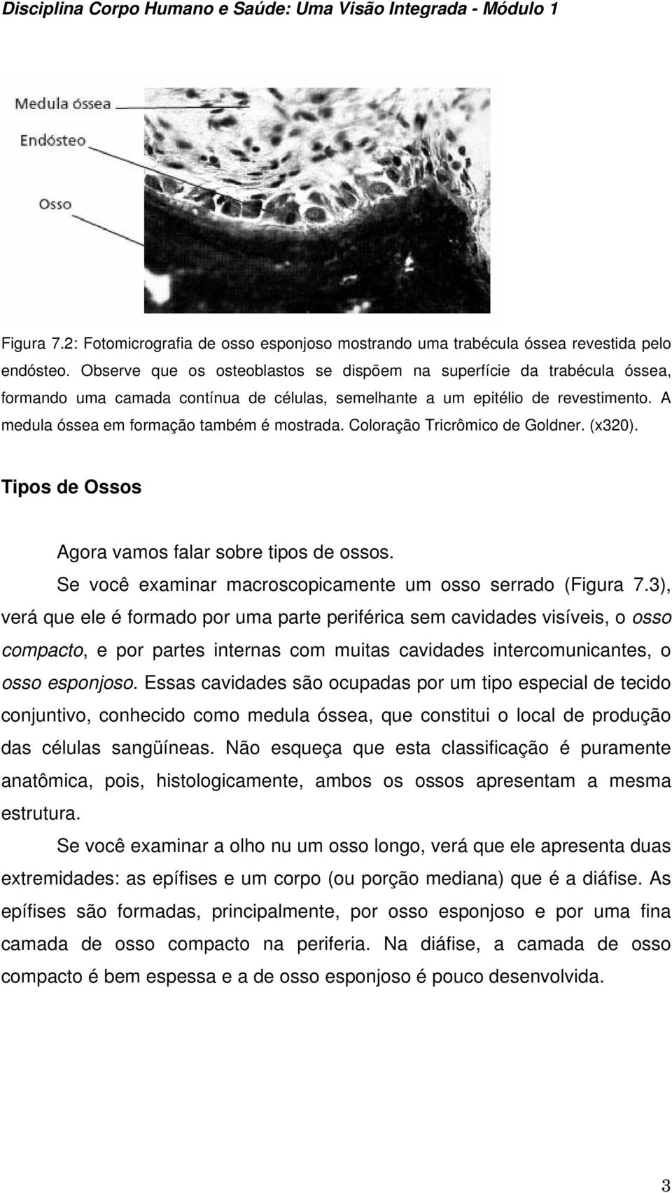 A medula óssea em formação também é mostrada. Coloração Tricrômico de Goldner. (x320). Tipos de Ossos Agora vamos falar sobre tipos de ossos.