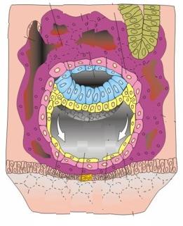 Células do hipoblasto se dividem e recobrem a parte interna da blastocele formando uma camada conhecida como membrana de Heuser A
