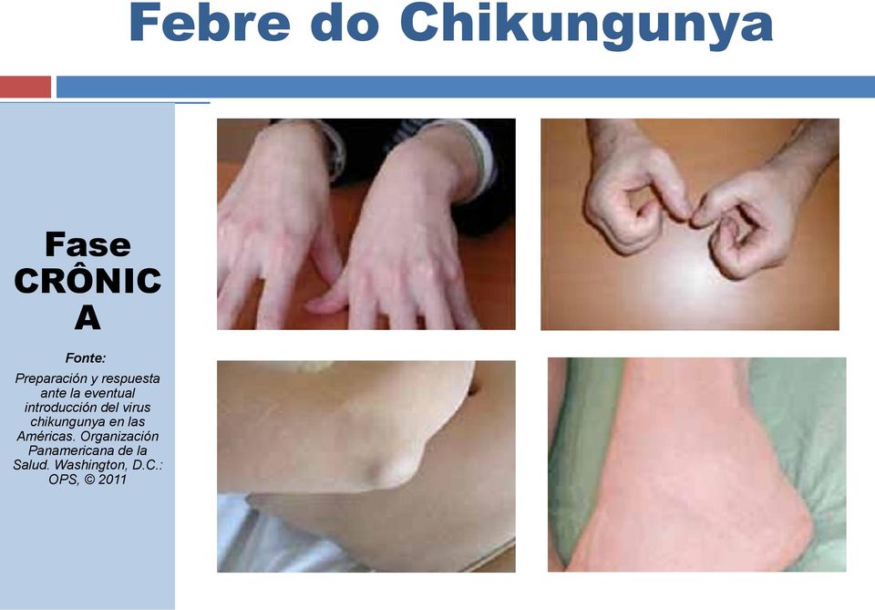 introducción del virus chikungunya en las Américas.