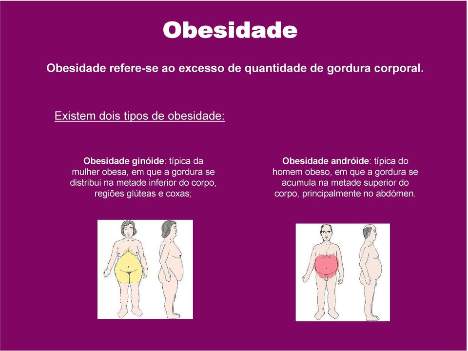 gordura se distribui na metade inferior do corpo, regiões glúteas e coxas; Obesidade