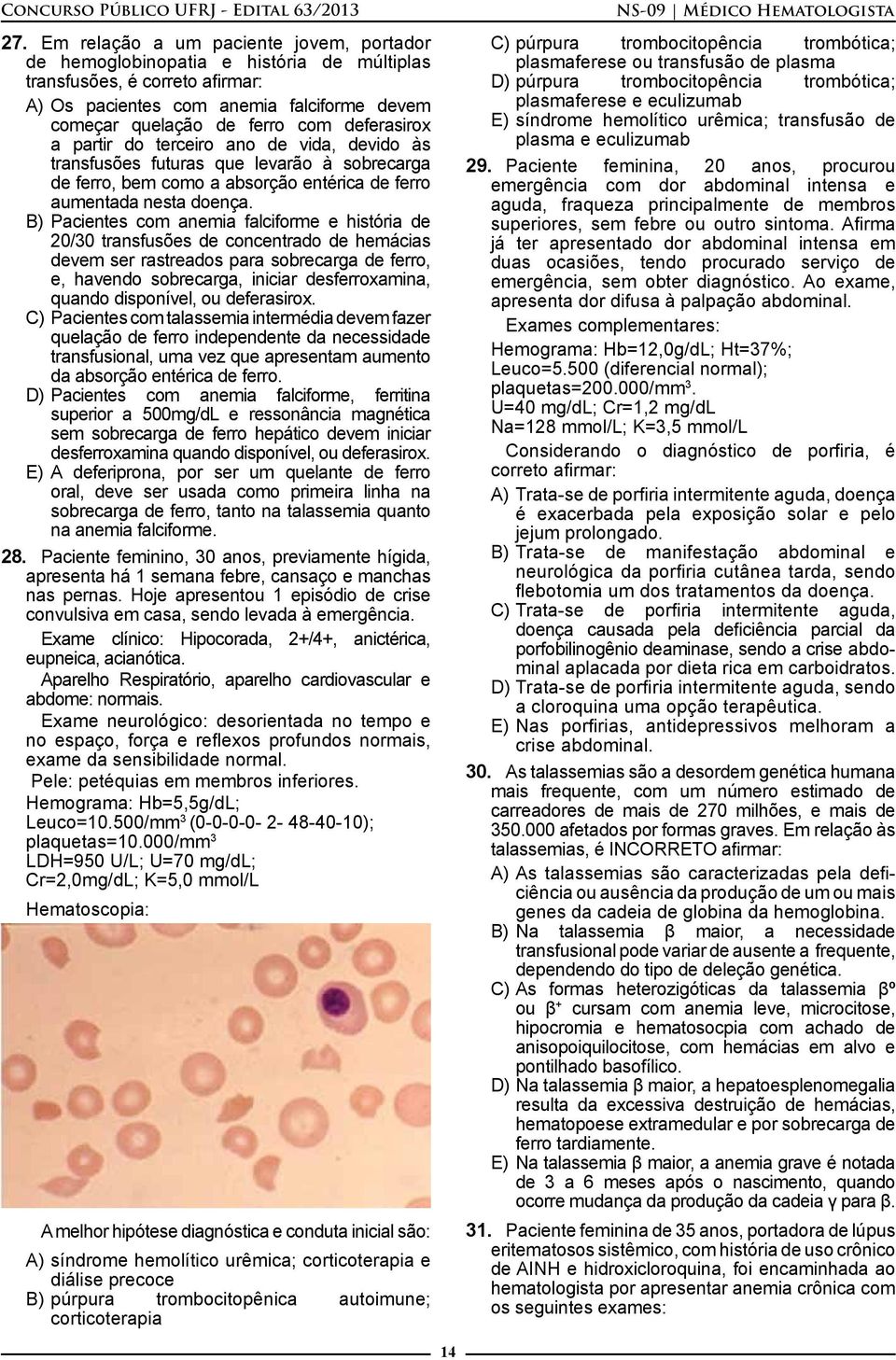 B) Pacientes com anemia falciforme e história de 20/30 transfusões de concentrado de hemácias devem ser rastreados para sobrecarga de ferro, e, havendo sobrecarga, iniciar desferroxamina, quando