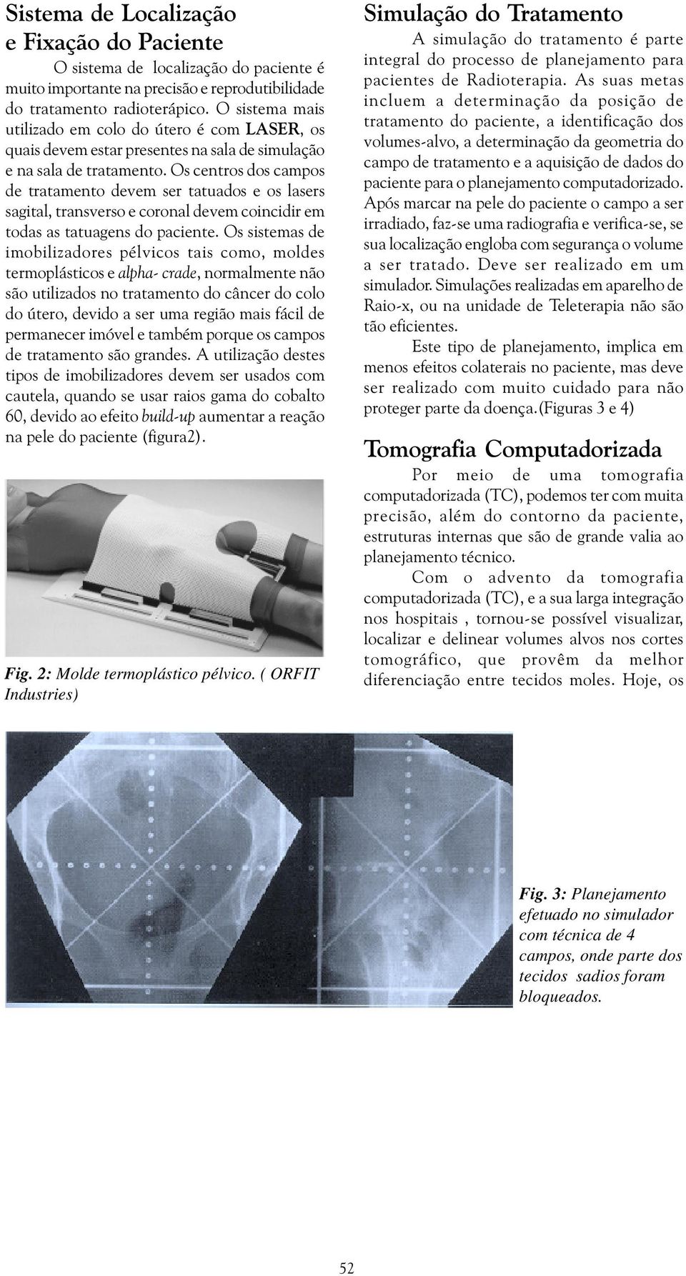 Os centros dos campos de tratamento devem ser tatuados e os lasers sagital, transverso e coronal devem coincidir em todas as tatuagens do paciente.