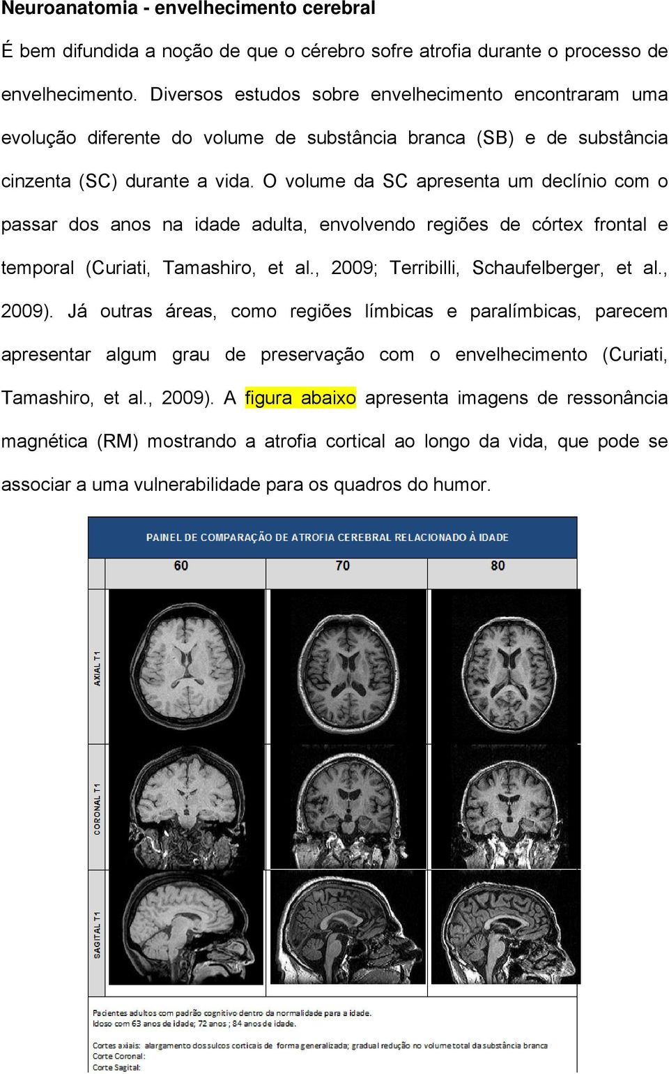 O volume da SC apresenta um declínio com o passar dos anos na idade adulta, envolvendo regiões de córtex frontal e temporal (Curiati, Tamashiro, et al., 2009; Terribilli, Schaufelberger, et al.