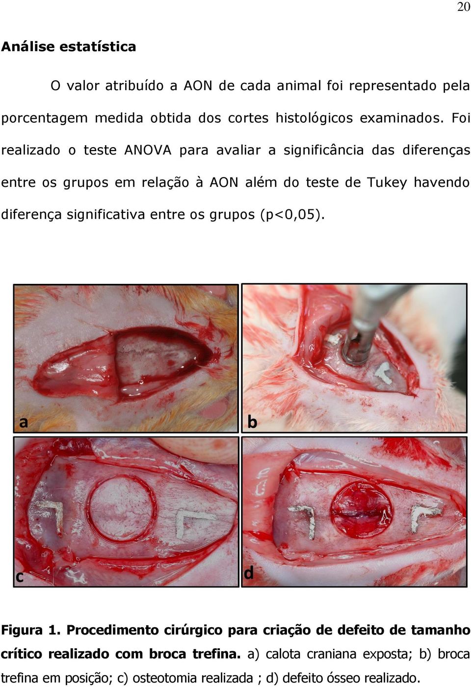 Foi realizado o teste ANOVA para avaliar a significância das diferenças entre os grupos em relação à AON além do teste de Tukey havendo