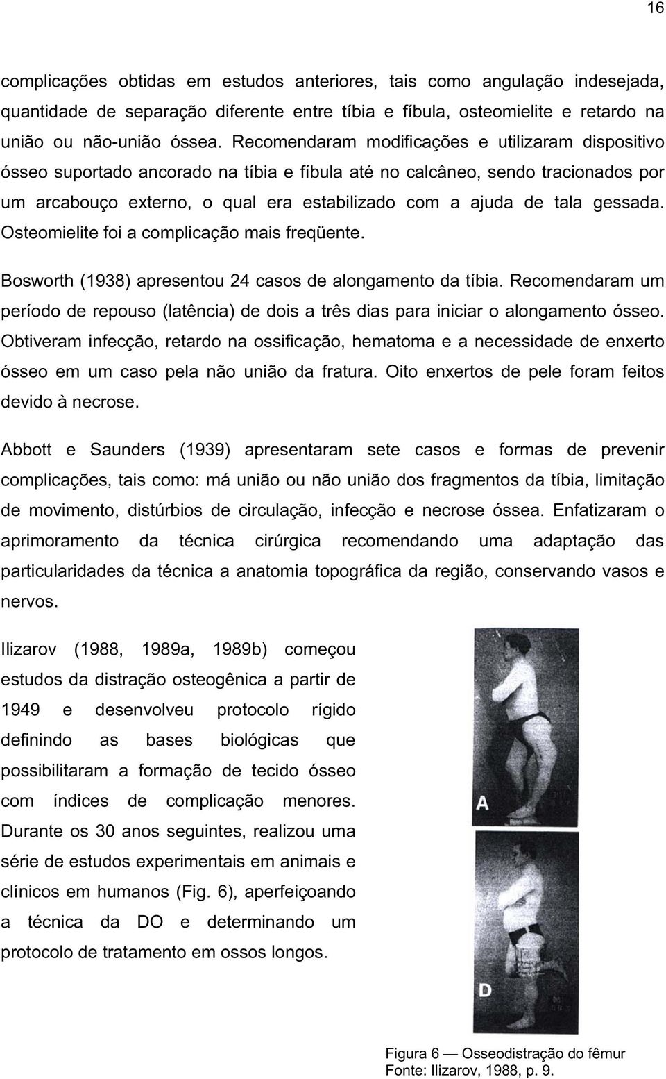 gessada. Osteomielite foi a complicação mais freqüente. Bosworth (1938) apresentou 24 casos de alongamento da tíbia.