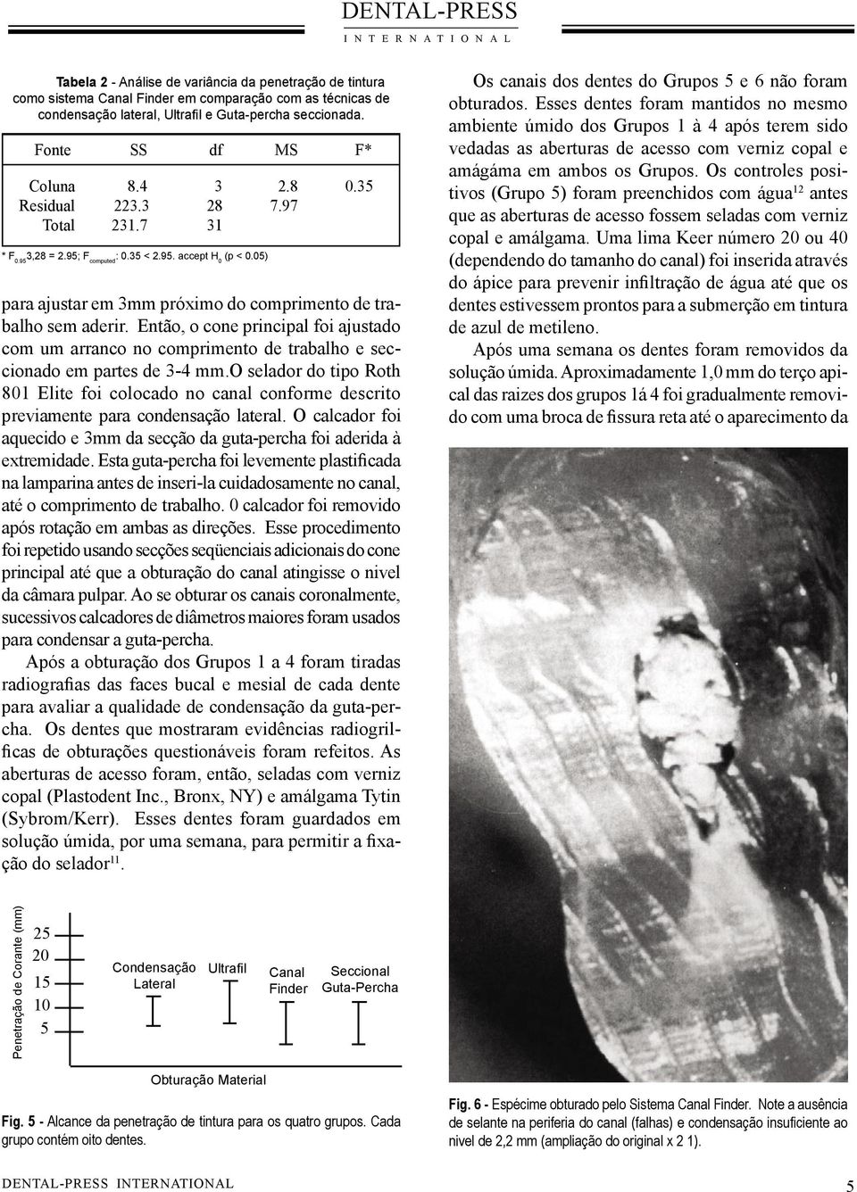 5) para ajustar em 3mm próximo do comprimento de trabalho sem aderir. Então, o cone principal foi ajustado com um arranco no comprimento de trabalho e seccionado em partes de 3-4 mm.