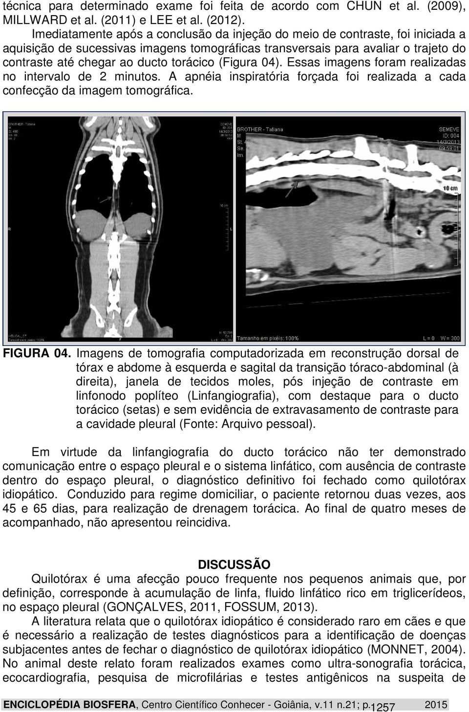 torácico (Figura 04). Essas imagens foram realizadas no intervalo de 2 minutos. A apnéia inspiratória forçada foi realizada a cada confecção da imagem tomográfica. FIGURA 04.