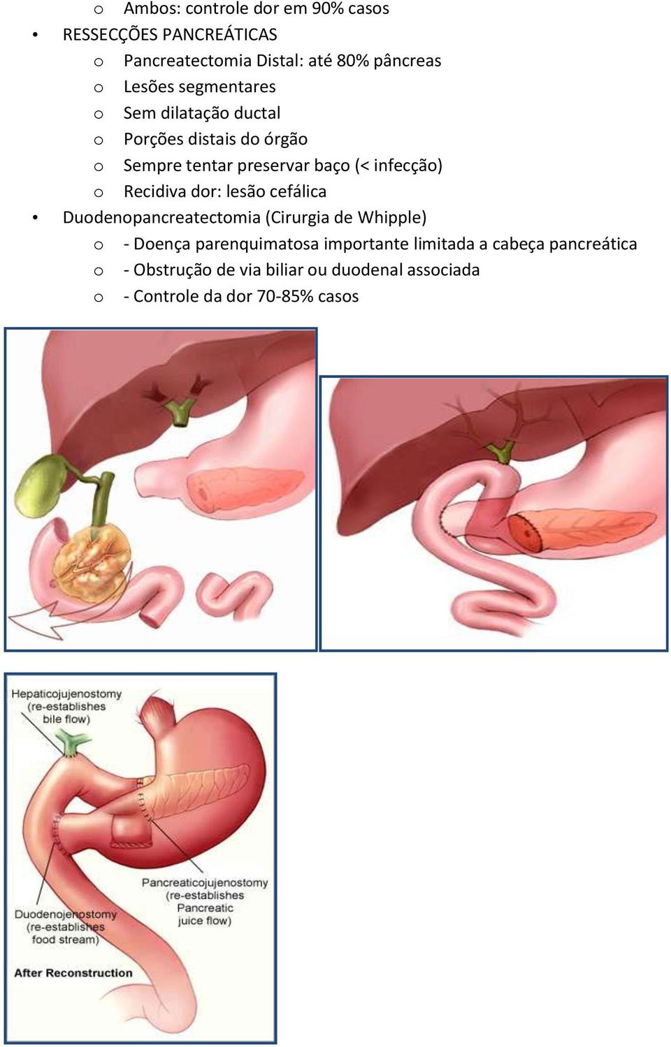 Recidiva dr: lesã cefálica Dudenpancreatectmia (Cirurgia de Whipple) - Dença parenquimatsa
