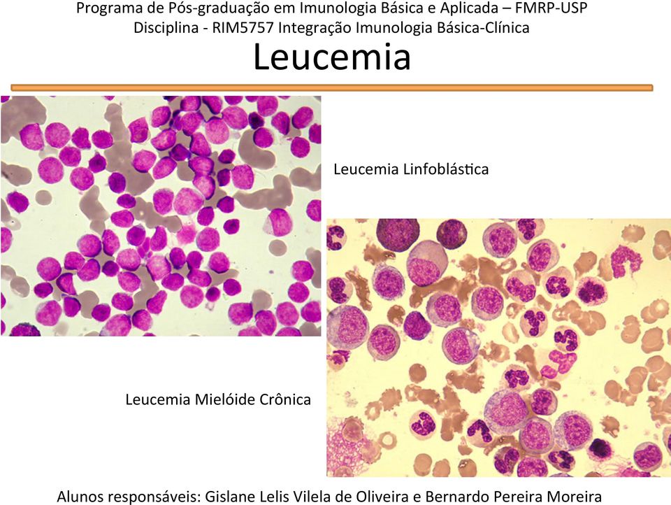 Leucemia Leucemia Linfoblás'ca Leucemia Mielóide Crônica Alunos