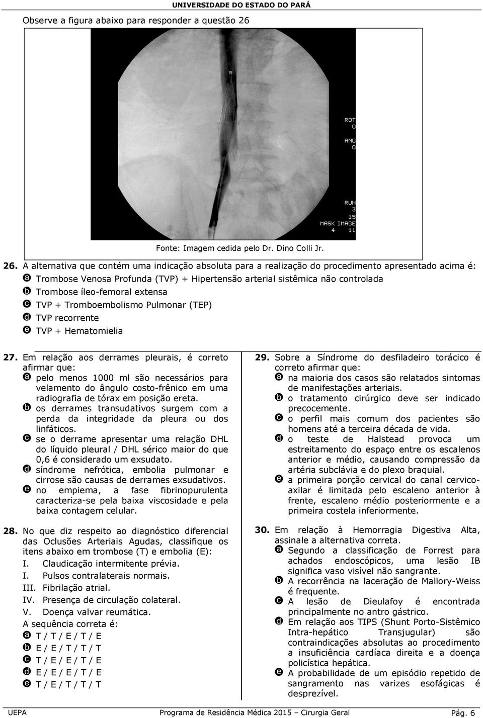 A alternativa que contém uma indicação absoluta para a realização do procedimento apresentado acima é: a Trombose Venosa Profunda (TVP) + Hipertensão arterial sistêmica não controlada b Trombose