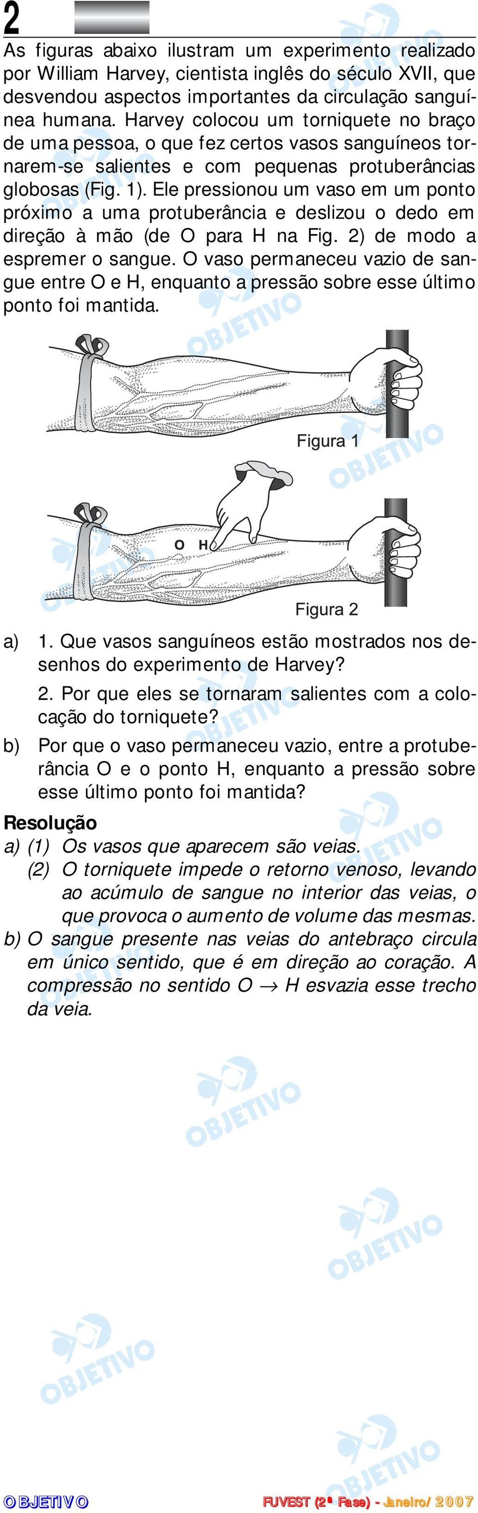 Ele pressionou um vaso em um ponto próximo a uma protuberância e deslizou o dedo em direção à mão (de O para H na Fig. 2) de modo a espremer o sangue.