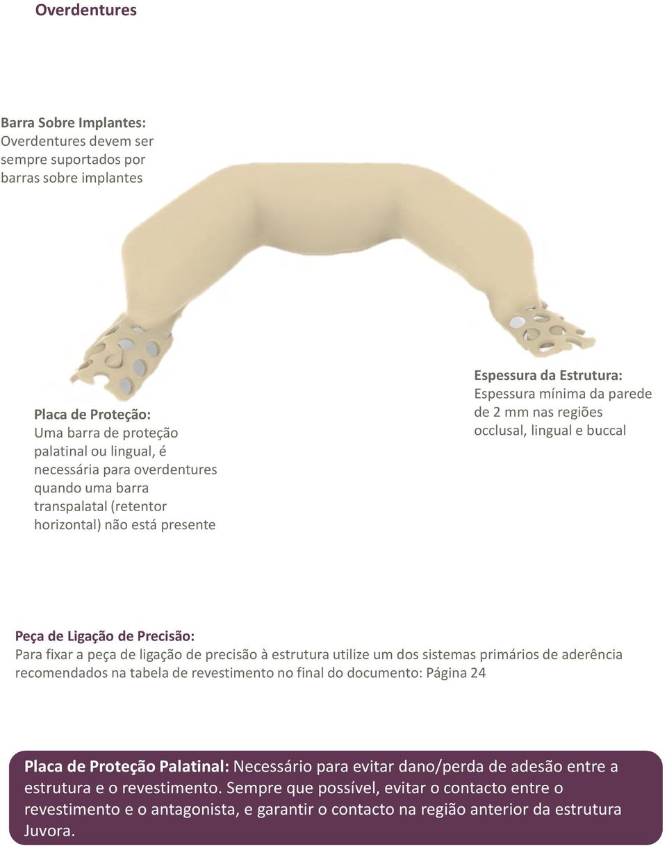 fixar a peça de ligação de precisão à estruturautilize um dos sistemas primários de aderência recomendados na tabela de revestimento no final do documento: Página 24 Placa de ProteçãoPalatinal: