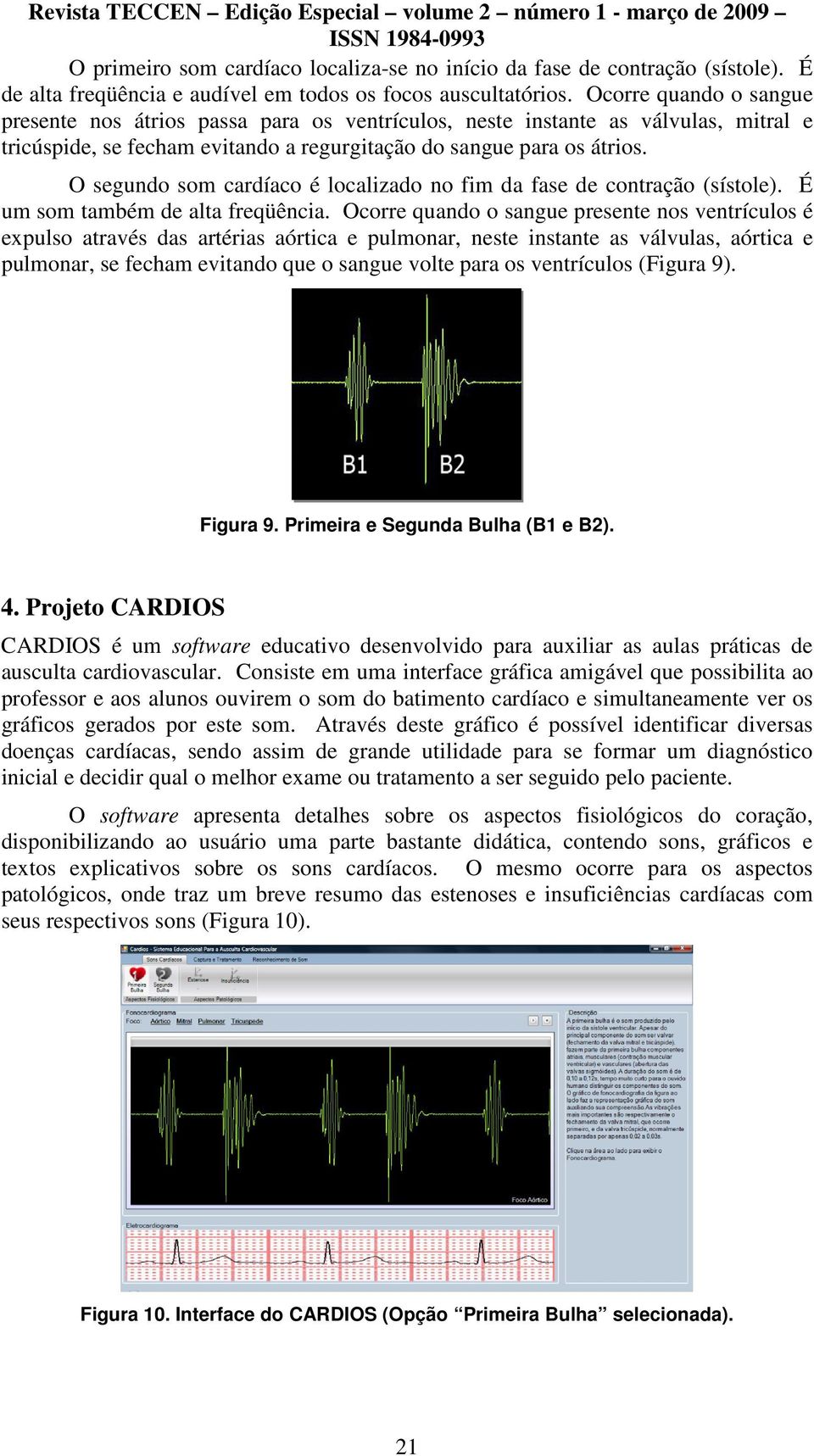 O segundo som cardíaco é localizado no fim da fase de contração (sístole). É um som também de alta freqüência.