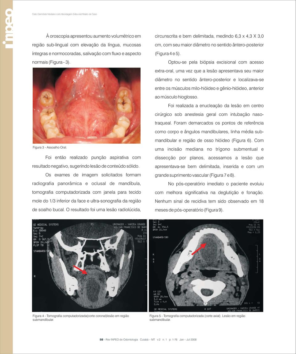 Os exames de imagem solicitados formam radiografia panorâmica e oclusal de mandíbula, tomografia computadorizada com janela para tecido mole do 1/3 inferior da face e ultra-sonografia da região de