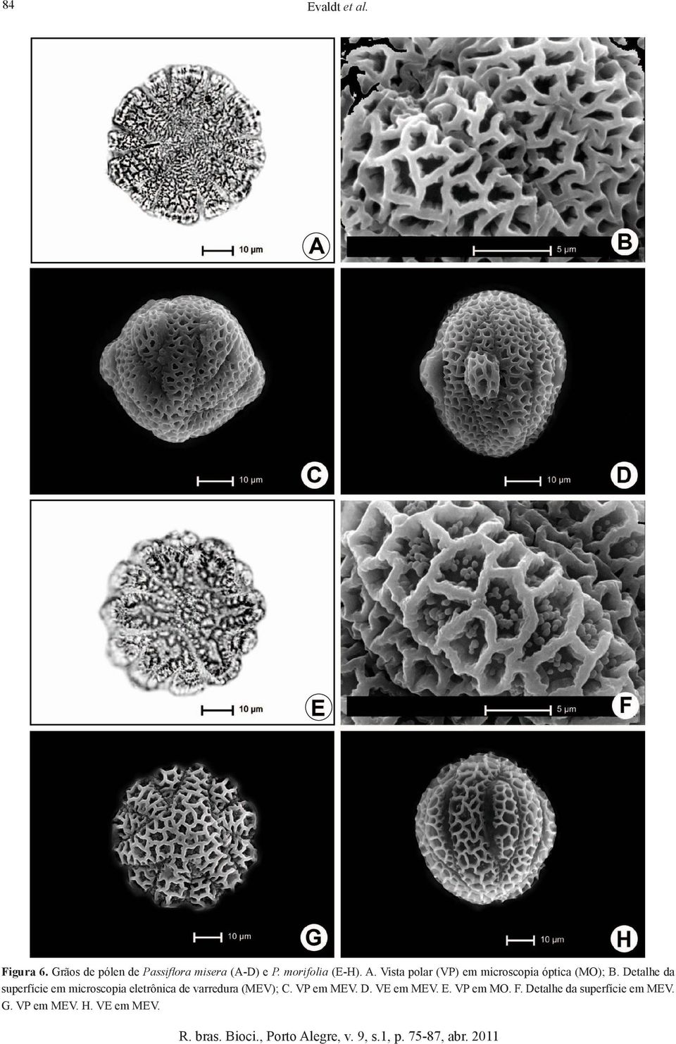 Detalhe da superfície em microscopia eletrônica de varredura (MEV); C.