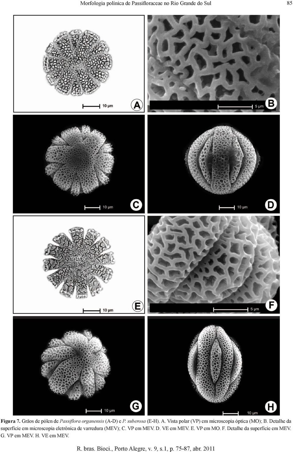 Vista polar (VP) em microscopia óptica (MO); B.