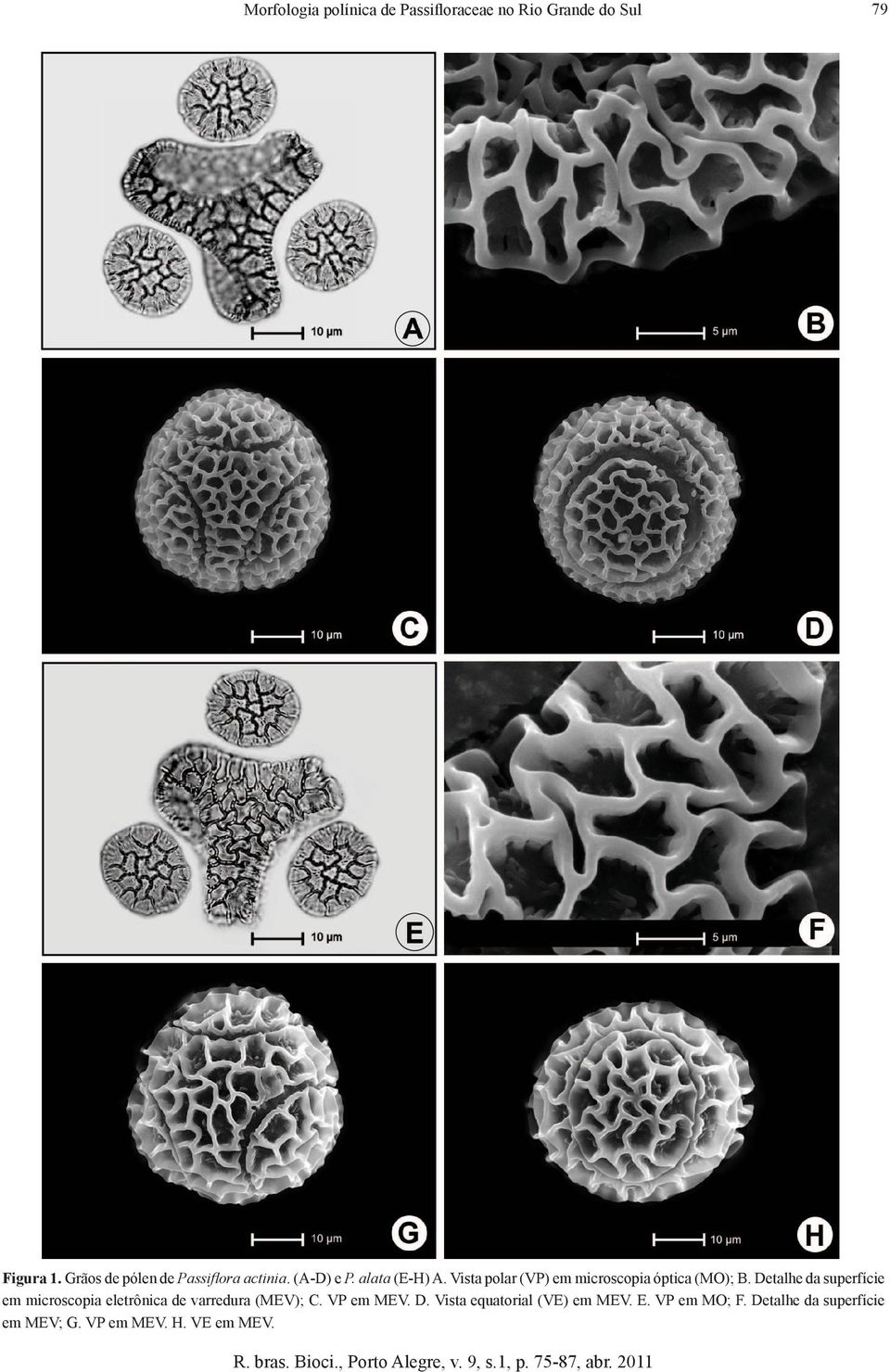 Vista polar (VP) em microscopia óptica (MO); B.