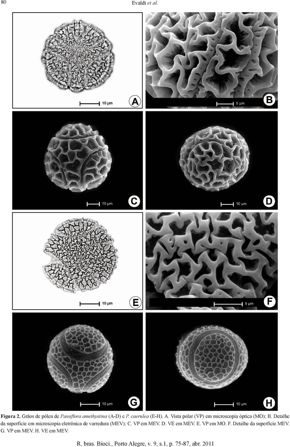 Detalhe da superfície em microscopia eletrônica de varredura (MEV); C.