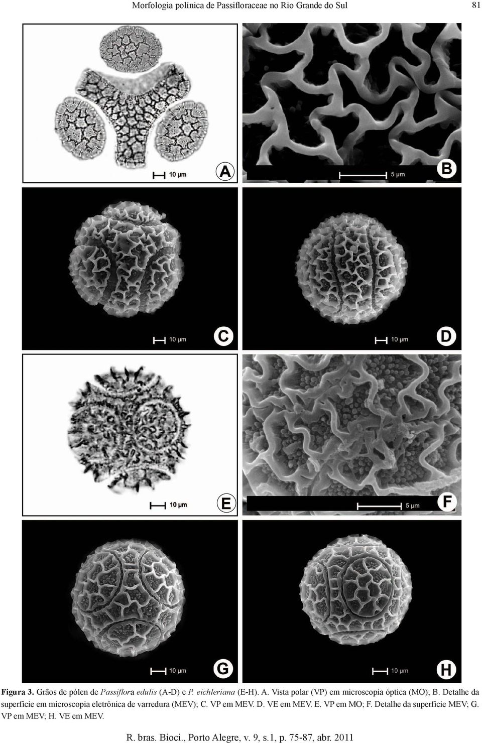 Vista polar (VP) em microscopia óptica (MO); B.