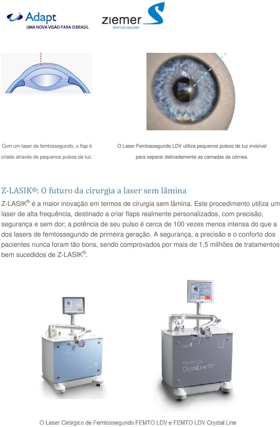 Z-LASIK : O futuro da cirurgia a laser sem lâmina Z-LASIK é a maior inovação em termos de cirurgia sem lâmina.