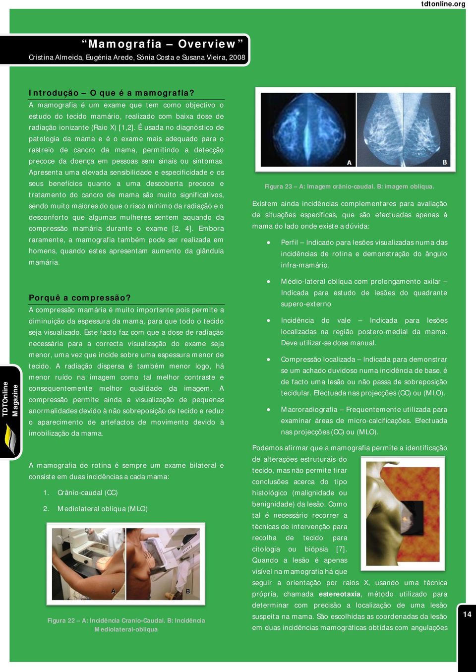 É usada no diagnóstico de patologia da mama e é o exame mais adequado para o rastreio de cancro da mama, permitindo a detecção precoce da doença em pessoas sem sinais ou sintomas.